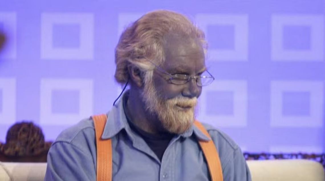 Paul Karason's blue skin (Image via Getty)